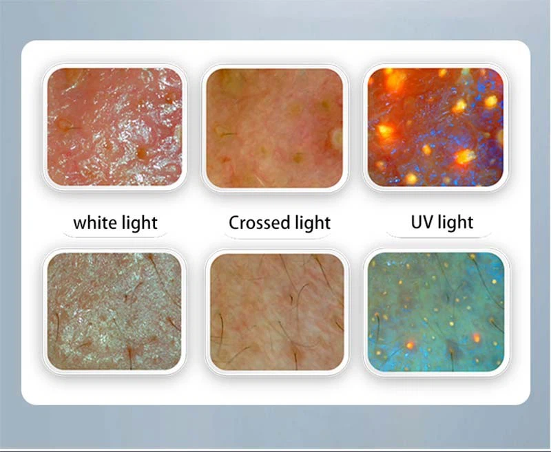 AI Skin Image Analyzer