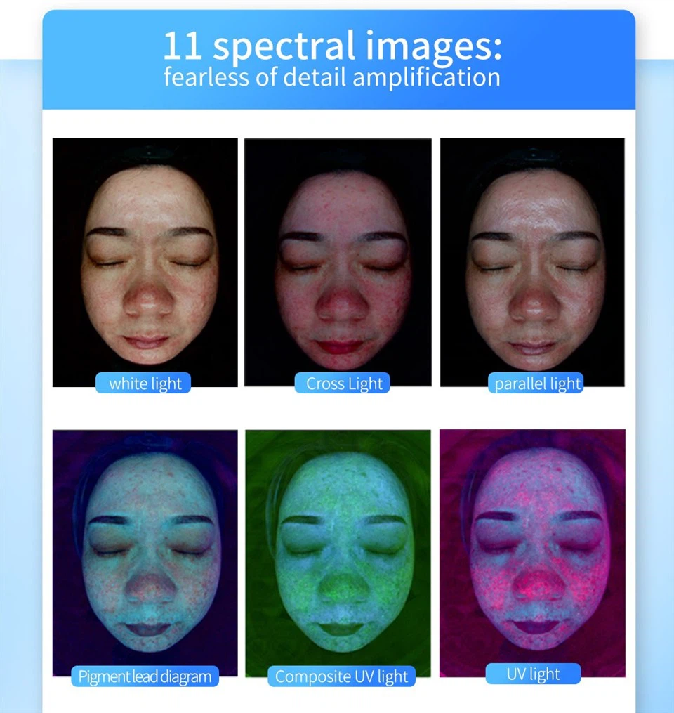 MNLT AI Skin Analysis Device – 3D 9-Spectrum Smart Analyzer high quality