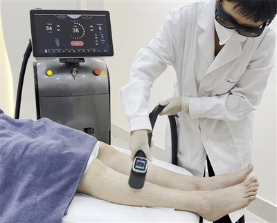 Prečo je sopránový titánový diódový laser zlatým štandardom na trvalé odstrán...